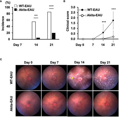 Autoimmune uveitis attenuated in diabetic mice through imbalance of Th1/Th17 differentiation via suppression of AP-1 signaling pathway in Th cells